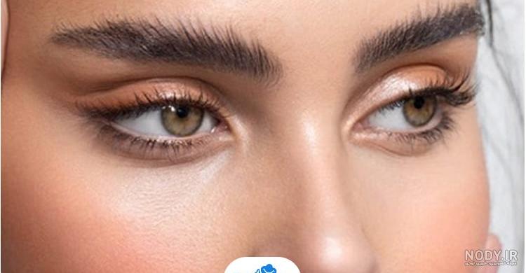 بوتاکس چشم گربه ای | قیمت لیفت چشم گربه ای با بوتاکس در اصفهان