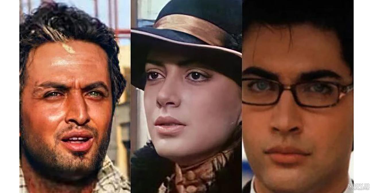 تزریق ژل به پلک چشم ✓ + فیلم و عکس ✔️ مراقبت های بعد از تزریق ژل | مرکز زیبایی و لیزر تزریق ژل به پلک چشم ✓ + فیلم و عکس ✔️ مراقبت های بعد از تزریق ژل | مرکز زیبایی و لیزر
