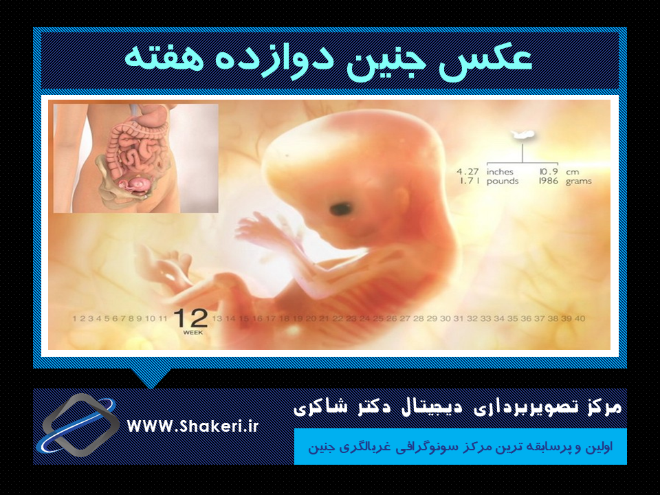 تعیین جنسیت جنین با سونوگرافی تعیین جنسیت جنین با سونوگرافی