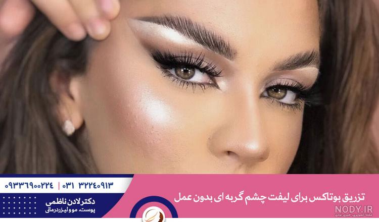 عمل زیبایی چشم روباهی و چشم گربه ای + حالت صورت - مجله عروسی