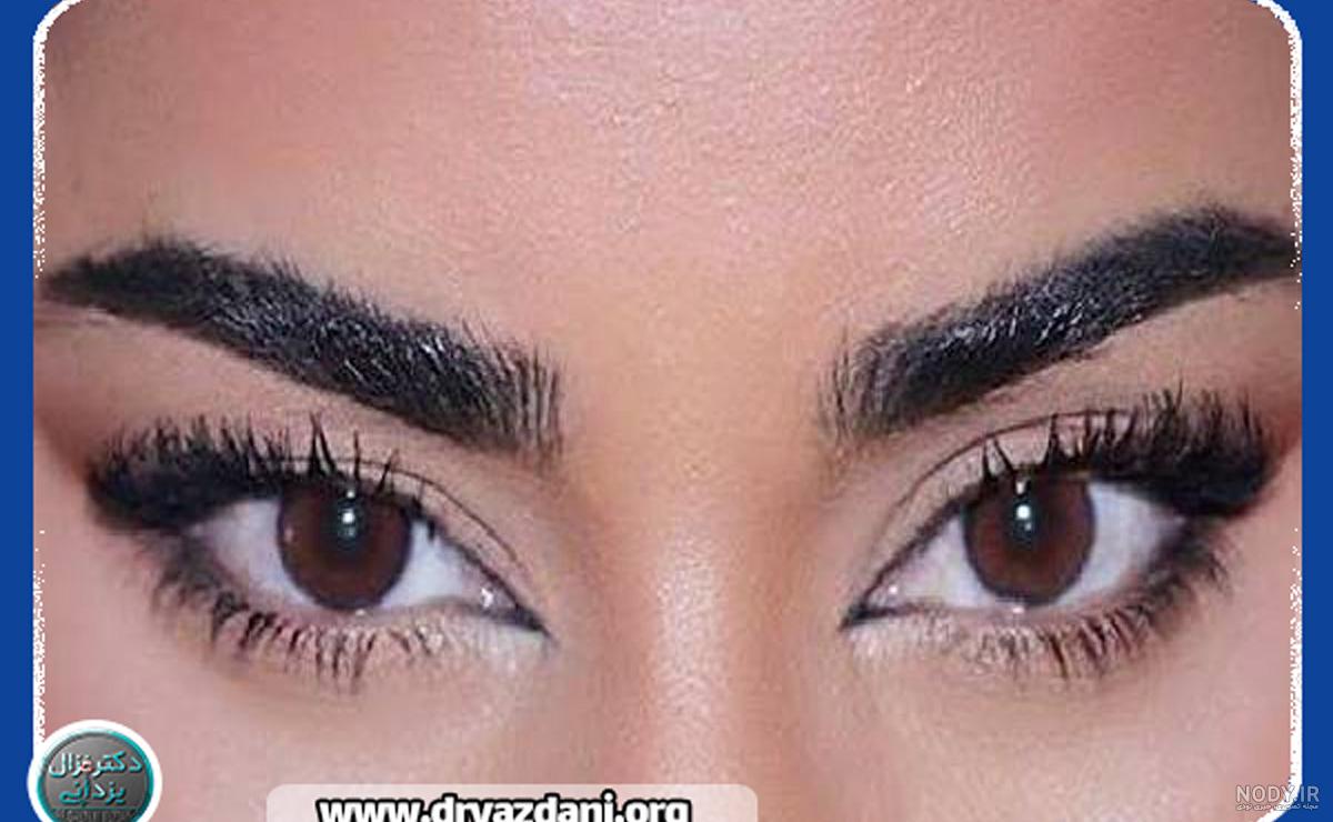 عمل زیبایی چشم گربه ای جراحان پلاستیک الیزه