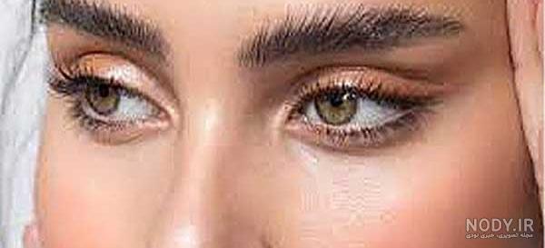 عمل چشم گربه ای چیست و چه خطراتی دارد؟