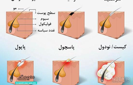 عکس انواع جوش