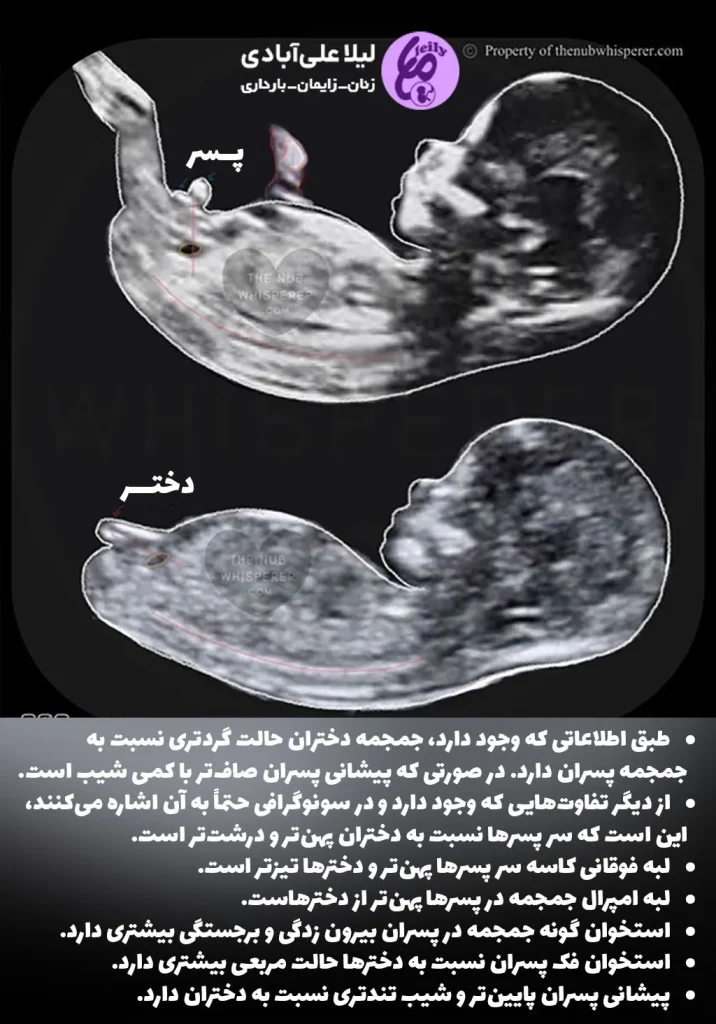 عکس جنین یک ماهه در رحم عکس جنین یک ماهه در رحم