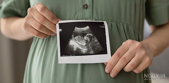 عکس جنین یک ماهه در شکم