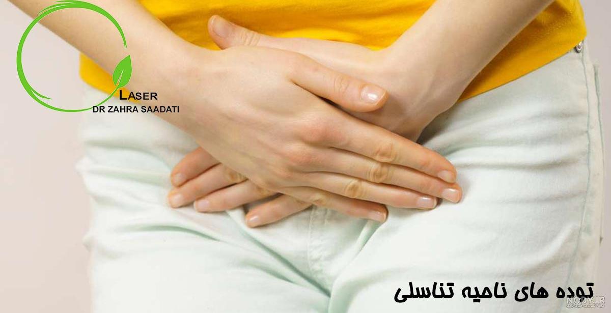 عکس جوش ناحیه تناسلی زنان و مردان; علل و درمان موضعی | کلینیک پایتخت