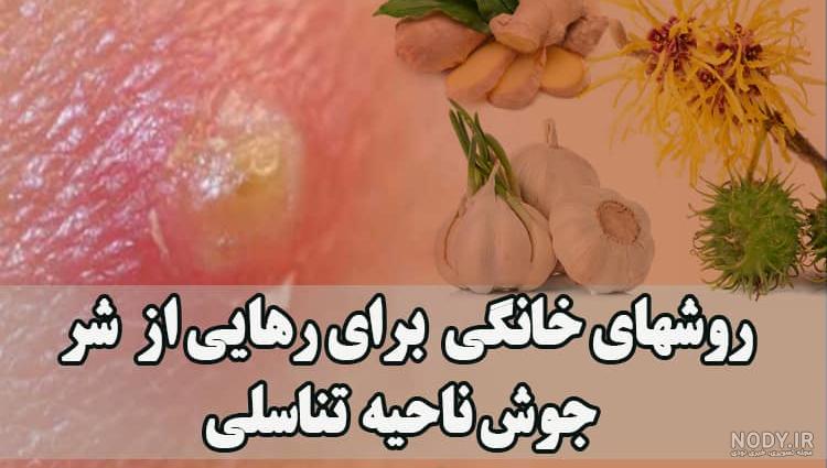 عکس جوش چرکی ناحیه تناسلی مردان