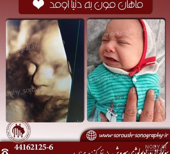 عکس رنگی از صورت جنین عکس رنگی از صورت جنین
