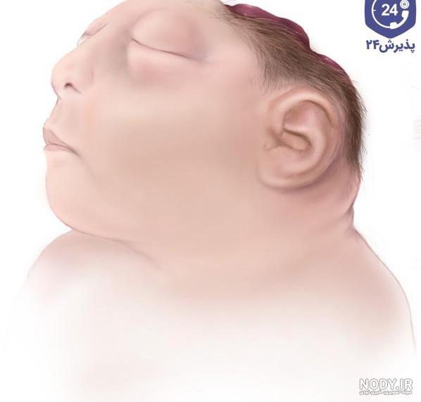 عکس صورت جنین در سونوگرافی عکس صورت جنین در سونوگرافی