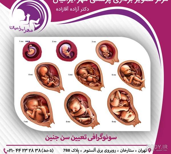 عکس صورت جنین در سونوگرافی نی نی سایت عکس صورت جنین در سونوگرافی نی نی سایت
