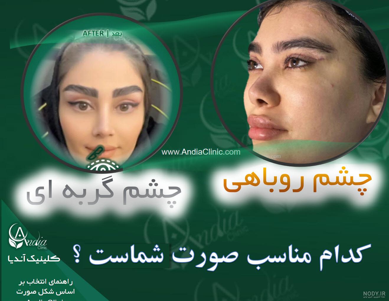 عکس پسر چشم گربه ای - عکس نودی