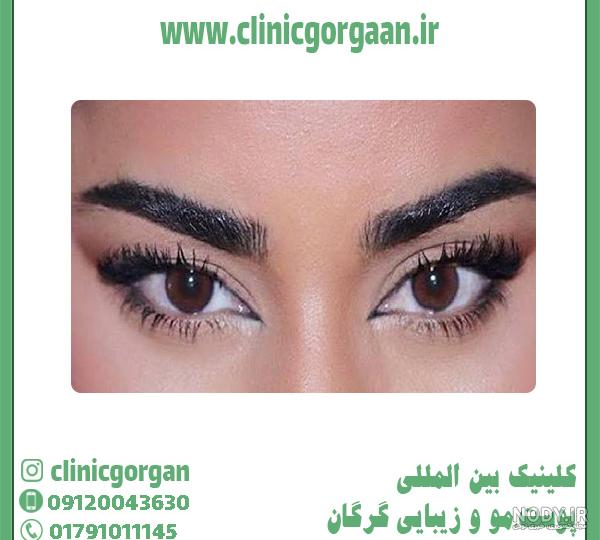 عکس چشم گربه ای طبیعی