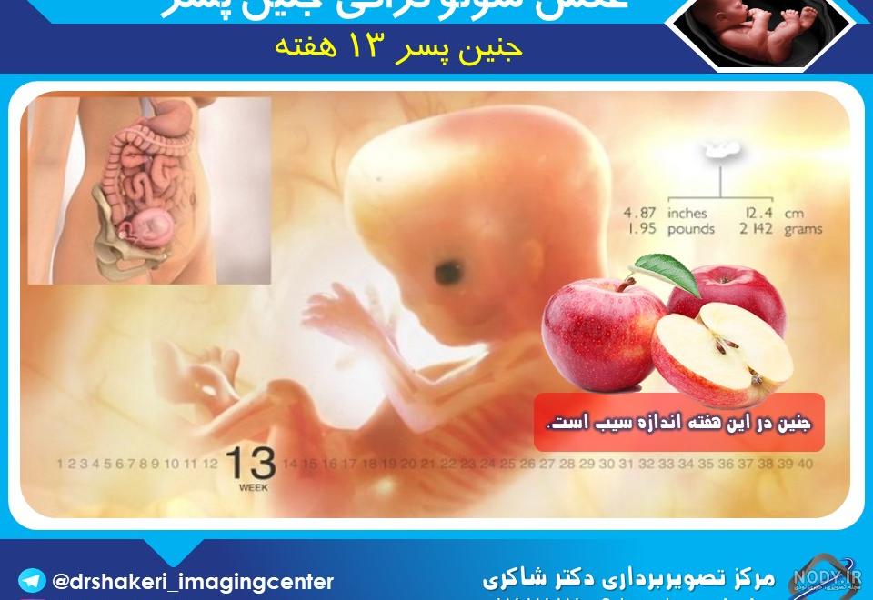 نحوه ی تشخیص جنسیت جنین از سونوگرافی | تفاوت جنین دختر و پسر | دکتر مرتضی جورابیان نحوه ی تشخیص جنسیت جنین از سونوگرافی | تفاوت جنین دختر و پسر | دکتر مرتضی جورابیان