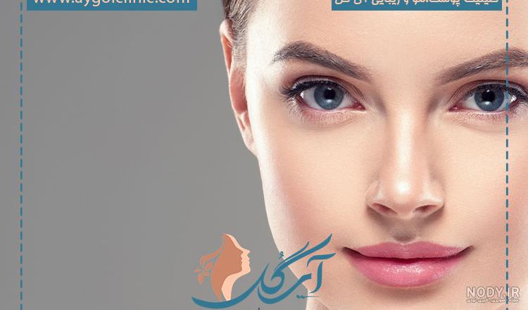 چشم گربه ای طبیعی - کلینیک بین المللی پوست و مو زیبایی قیطریه - مزایا و  معایب -