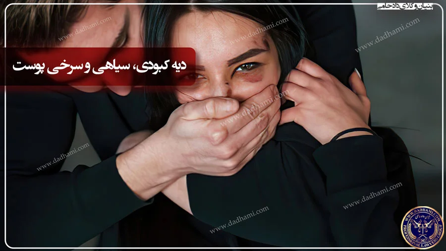 آموزش نحوه ایجاد کبودی غیر واقعی و فیک با لوازم آرایشی