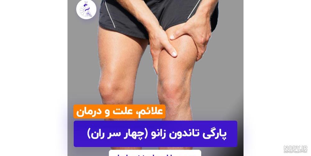 عکس از کبودی زانو