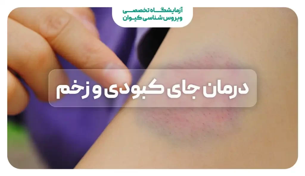 عکس بیمارستانی دخترانه و پسرانه برای استوری | عکس سرم دست عکس بیمارستانی دخترانه و پسرانه برای استوری | عکس سرم دست