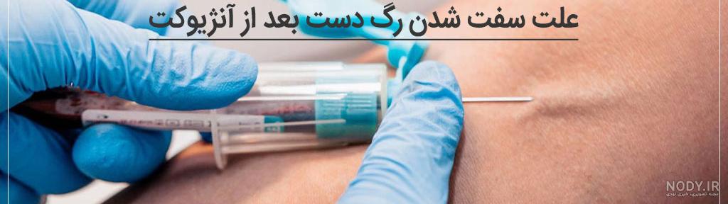 عکس دست کبود شده جای سرم