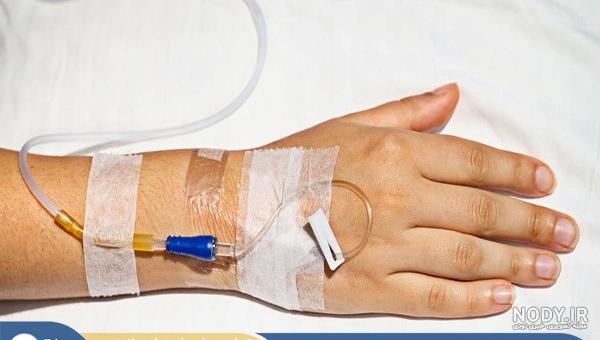 عکس کبودی دست بعد از سرم ❤️ [ بهترین تصاویر ]