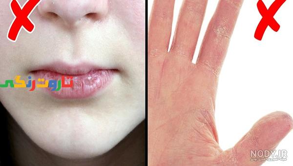 افشای علت پیری زودرس هدیه تهرانی ! + عکس افشای علت پیری زودرس هدیه تهرانی ! + عکس