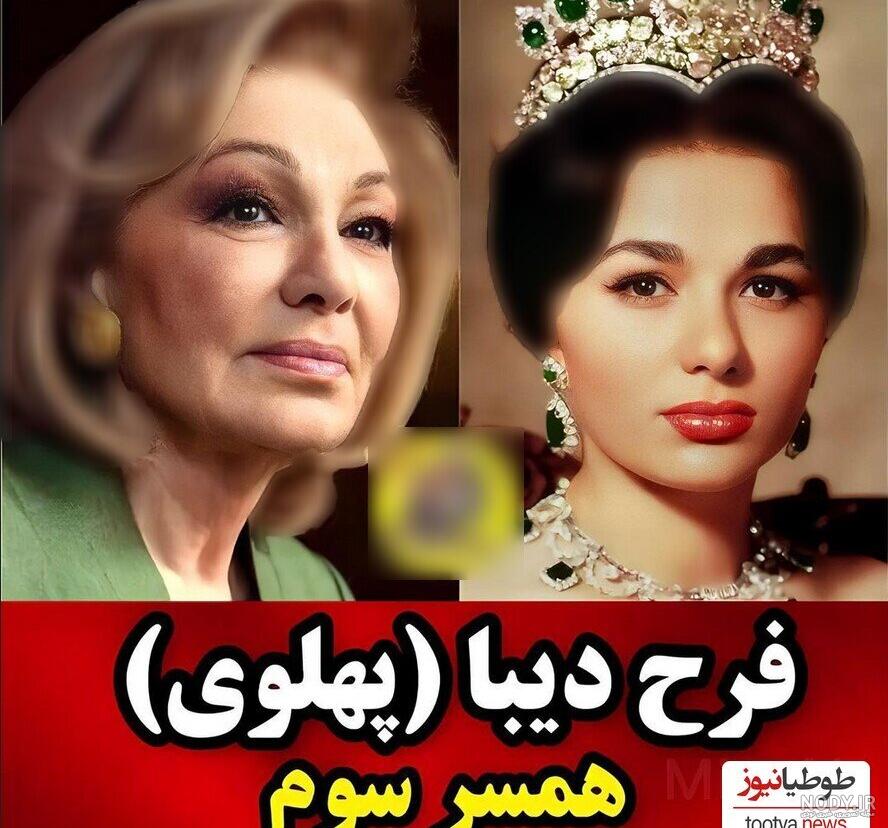بازیگر نقش شاه: به خاطر شاه، ۱۵ کیلو کم کردم! - تابناک | TABNAK بازیگر نقش شاه: به خاطر شاه، ۱۵ کیلو کم کردم! - تابناک | TABNAK