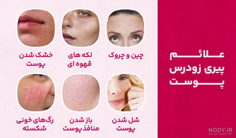 علائم پیری زودرس در جوانان و مردان + علت و درمان پیری زودرس علائم پیری زودرس در جوانان و مردان + علت و درمان پیری زودرس