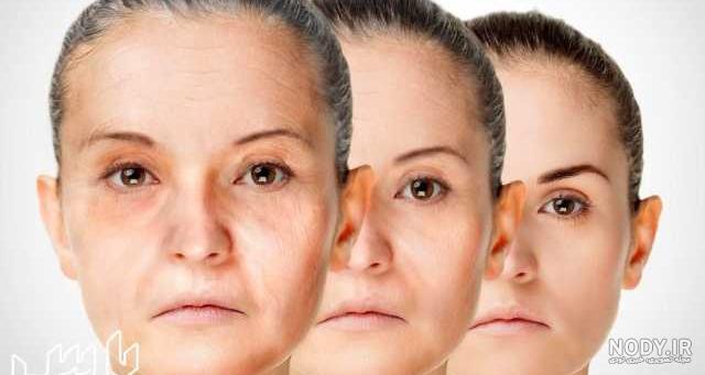 عکس دختر بچه ۱۰ساله | دختربچه 10ساله ای که بر اثر پیری زودرس درگذشت