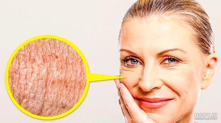 لکه های پیری (کبدی): علت، علائم و روش درمان و پیشگیری