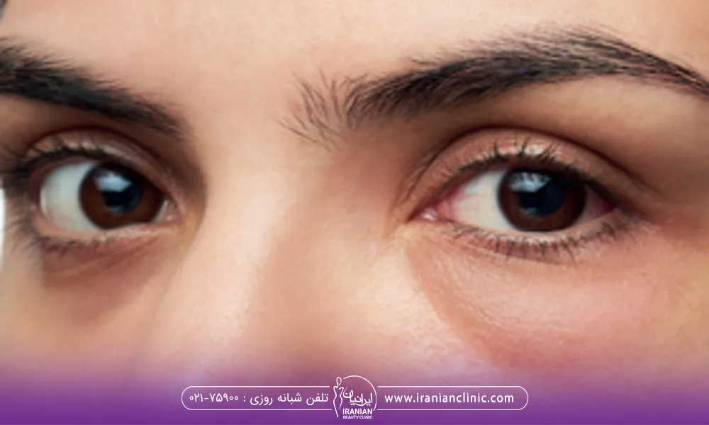 50 عکس پروفایل پسرانه 2024؛ کلی ایده خاص فیک و طبیعی بدون چهره با فاز غم شاد - گلی خانوم 50 عکس پروفایل پسرانه 2024؛ کلی ایده خاص فیک و طبیعی بدون چهره با فاز غم شاد - گلی خانوم