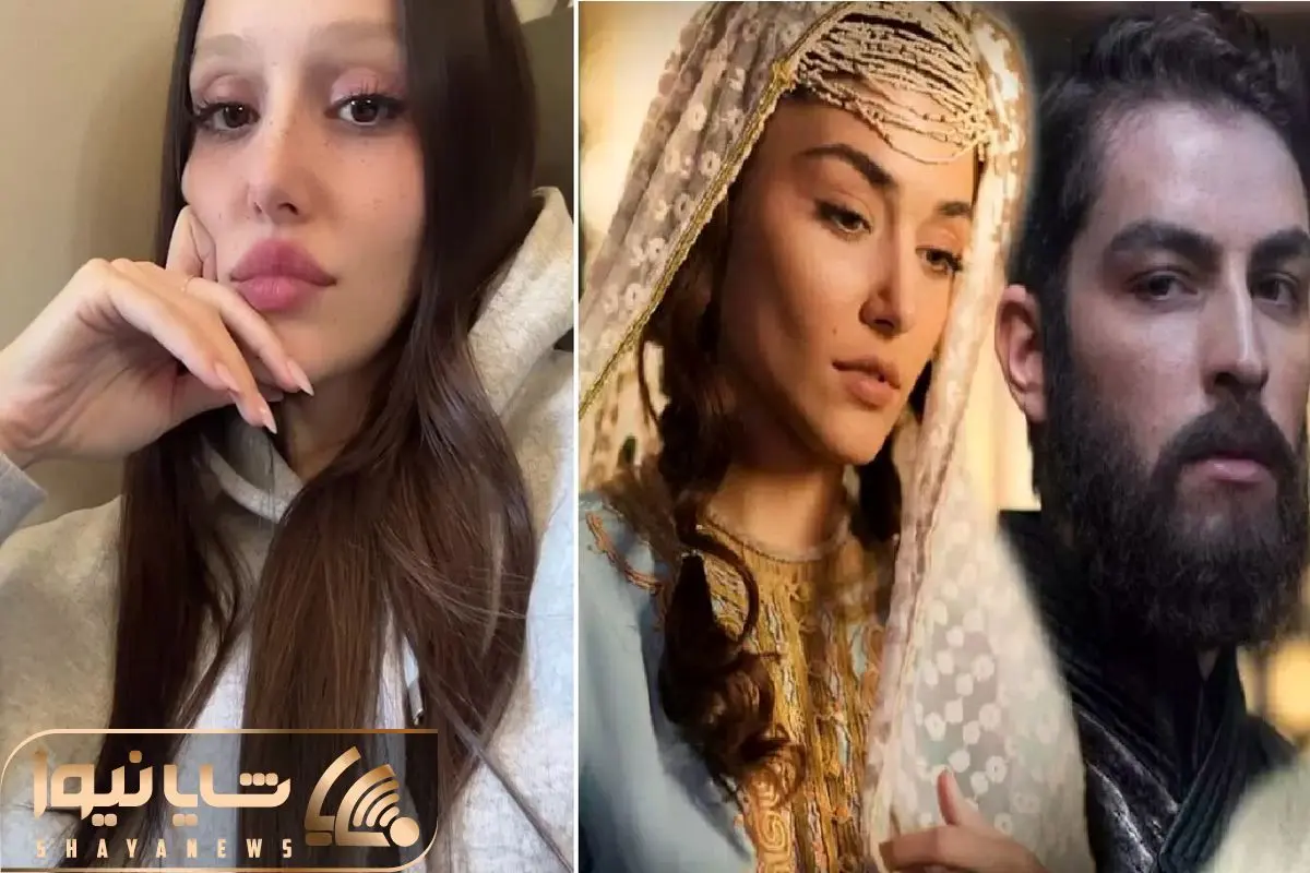تاثیر جراحی بوکال فت بر چهره هانده ارچل جنجال آفرین شد! تاثیر جراحی بوکال فت بر چهره هانده ارچل جنجال آفرین شد!