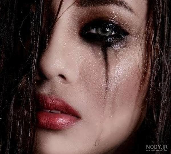 ترشحات چشم || پزشکت