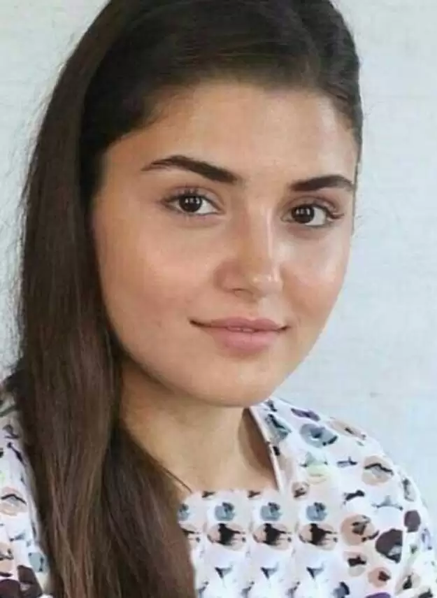عکس قبل عمل زیبایی هانده ارچل