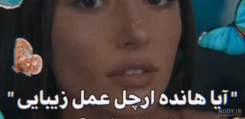 عکس/ محال با دیدن چهره هانده ارچل بدون آرایش او را بشناسید!