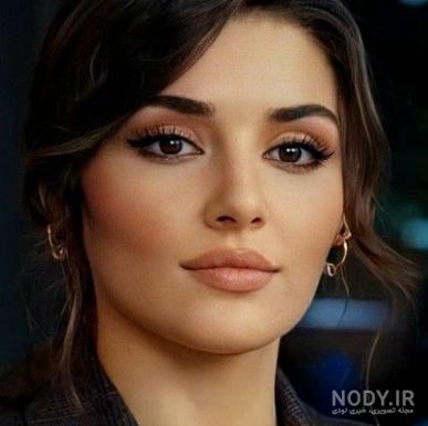عکس هانده ارچل بدون عمل | تصویری جالب از چهره بدون جراحی هانده ارچل