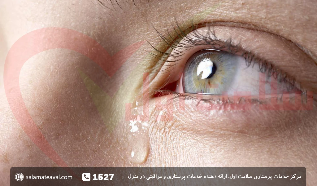 عکس پروفایل چشم اشک آلود