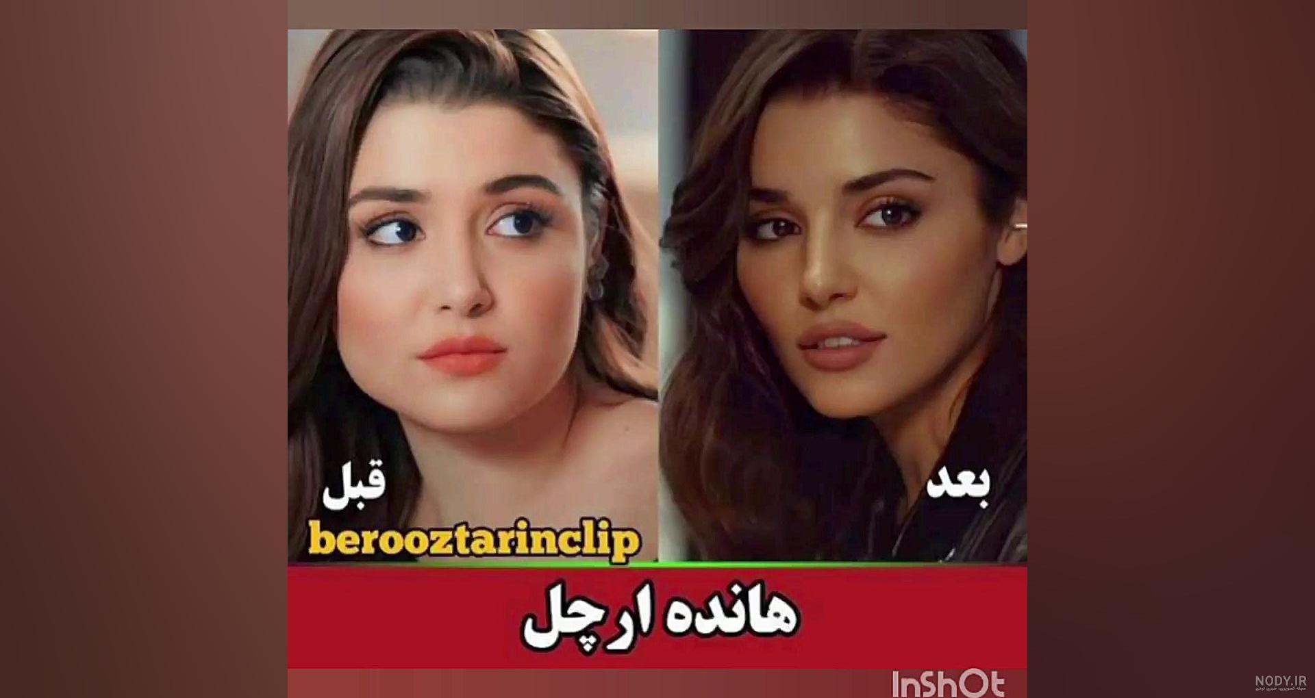 عکسی که ثابت می‌کند زیبایی هانده ارچل نچرال است و عملی نیست!