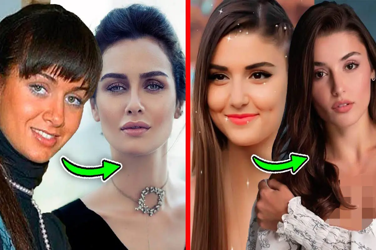 هانده ارچل + بیوگرافی و عکس قبل از عمل زیبایی - زیبامون هانده ارچل + بیوگرافی و عکس قبل از عمل زیبایی - زیبامون