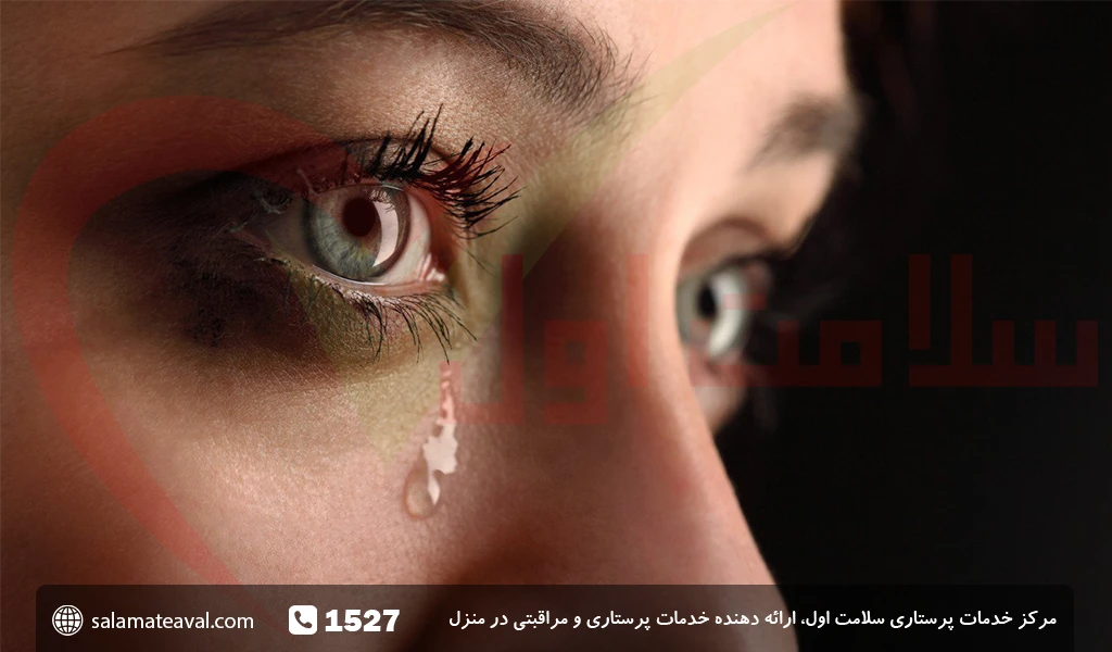 چرا چشمانم اشک آلود است؟ | لنزشو