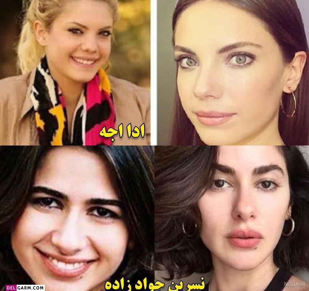 چهره بازیگران مطرح ترکیه ای قبل و بعد از عمل های متعدد زیبایی از هانده ارچل چهره بازیگران مطرح ترکیه ای قبل و بعد از عمل های متعدد زیبایی از هانده ارچل