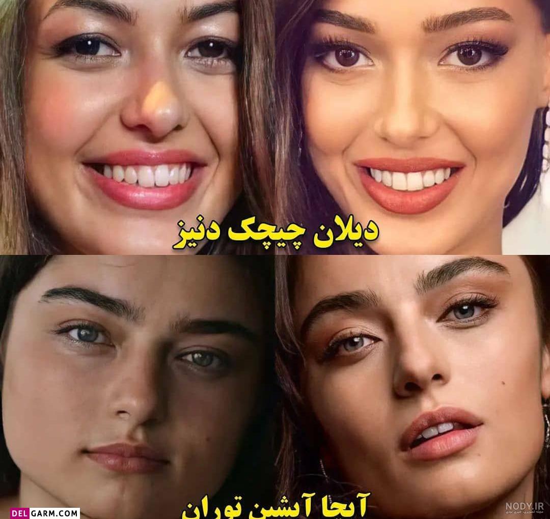 چهره قبل عمل بازیگران زن معروف ترک از هیلان تا هانده ارچل