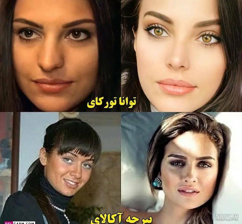 چهره قبل عمل زیبایی خانم بازیگران ترکیه ای / از هیلان تا هانده ارچل! + عکس  های باورنکردنی