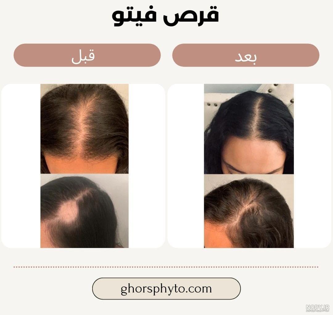5 روش تشخیص قرص فیتو اصل و فیک {ساده و سریع} + تصاویر