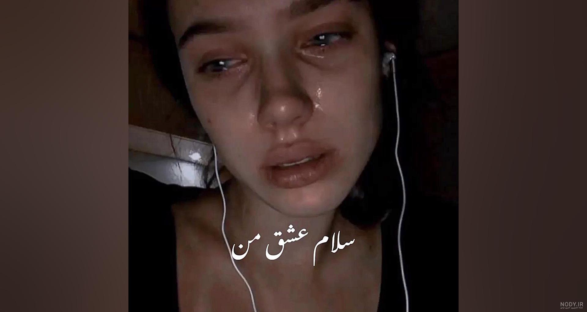بریدگی کف دست | دست بریده شده با چاقو یا شیشه بریدگی کف دست | دست بریده شده با چاقو یا شیشه