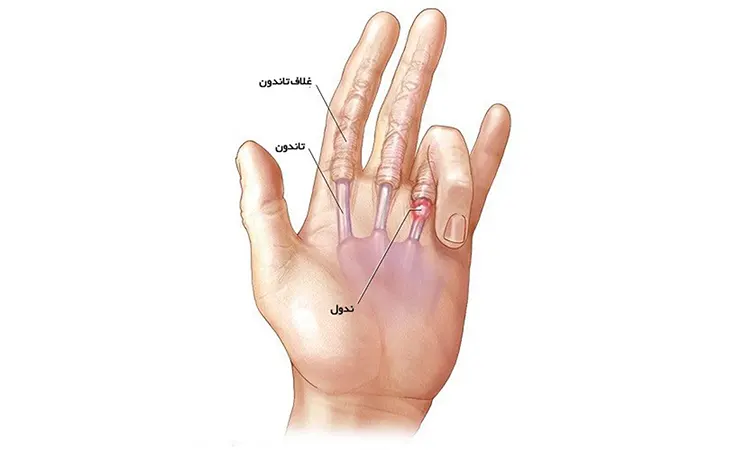 عکس فیک رگ دست دختر عکس فیک رگ دست دختر