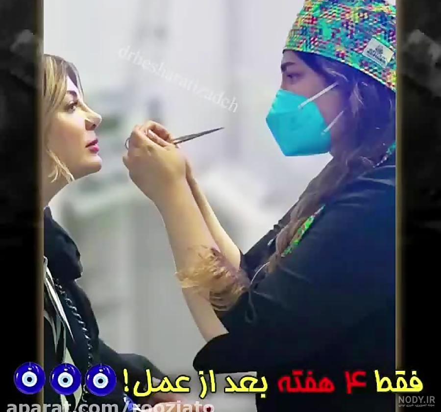 تغییر چهره نیوشا ضیغمی بعد از عمل مجدد بینی تغییر چهره نیوشا ضیغمی بعد از عمل مجدد بینی