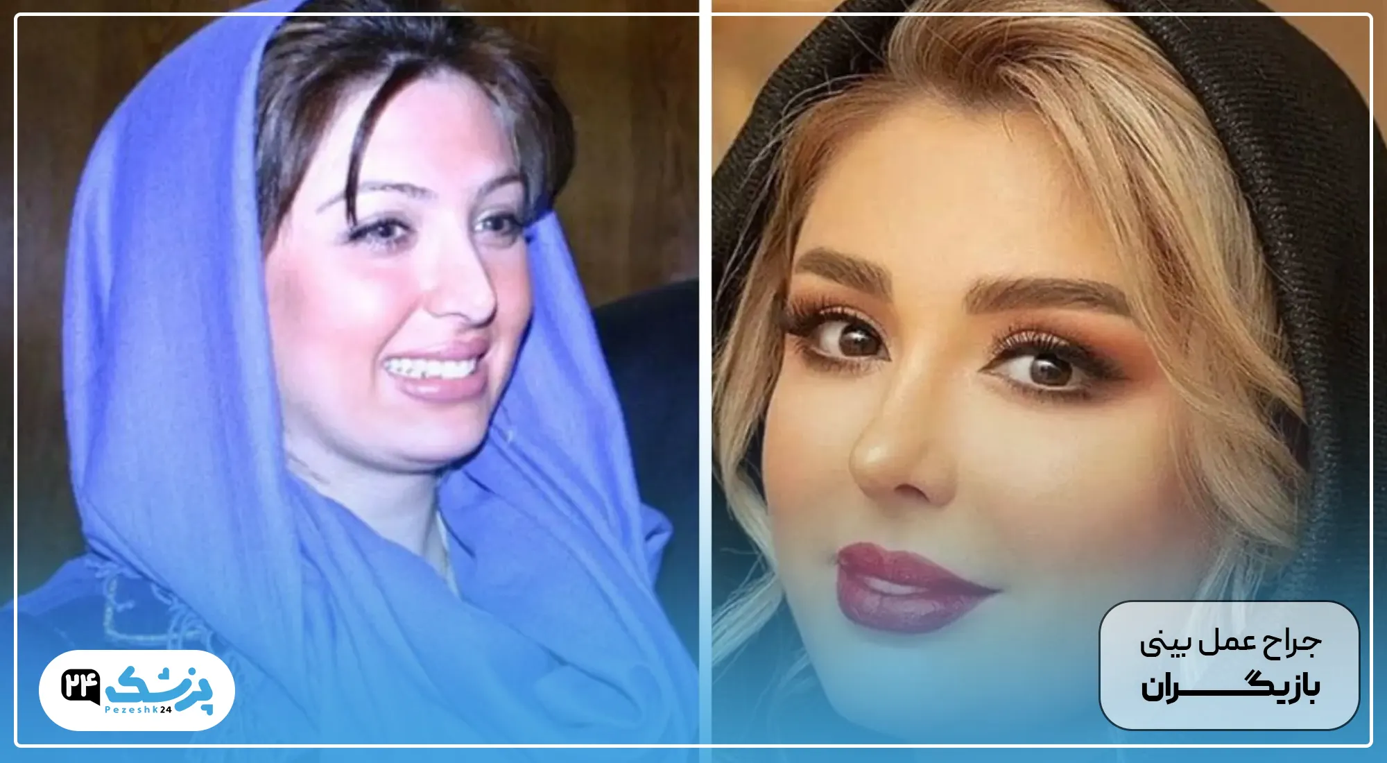 جدیدترین عکس از نیوشا ضیغمی بعد از عمل زیبایی / متفاوت تر از همیشه ! جدیدترین عکس از نیوشا ضیغمی بعد از عمل زیبایی / متفاوت تر از همیشه !
