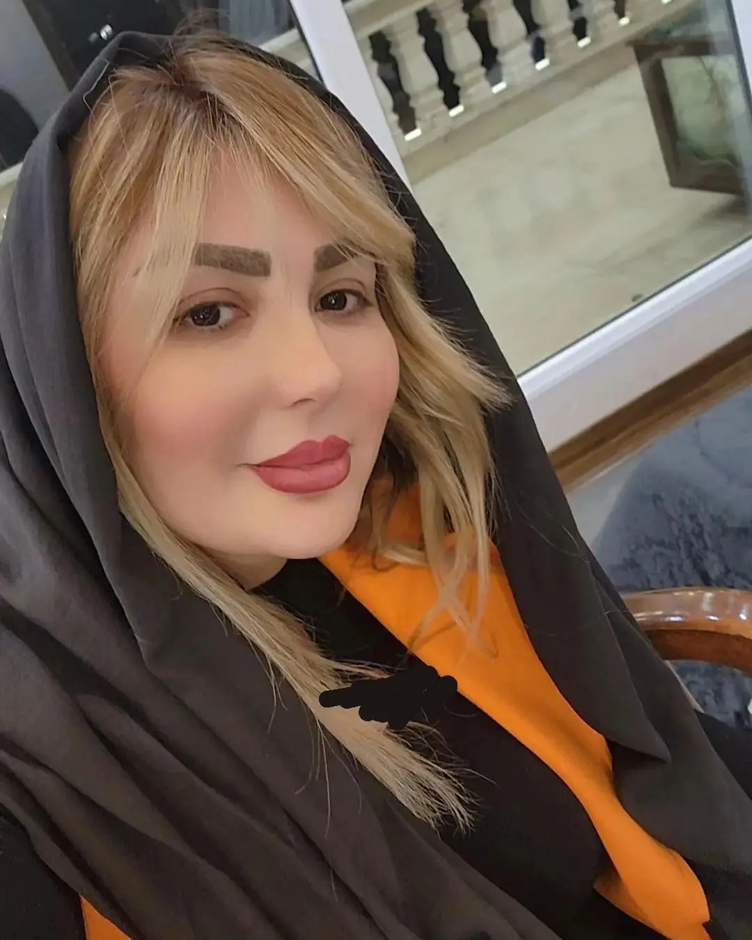 جراحی بینی نیوشا ضیغمی توسط بهترین جراح بینی تهران دکتر بشارتی زاده 🌟 جراحی بینی نیوشا ضیغمی توسط بهترین جراح بینی تهران دکتر بشارتی زاده 🌟