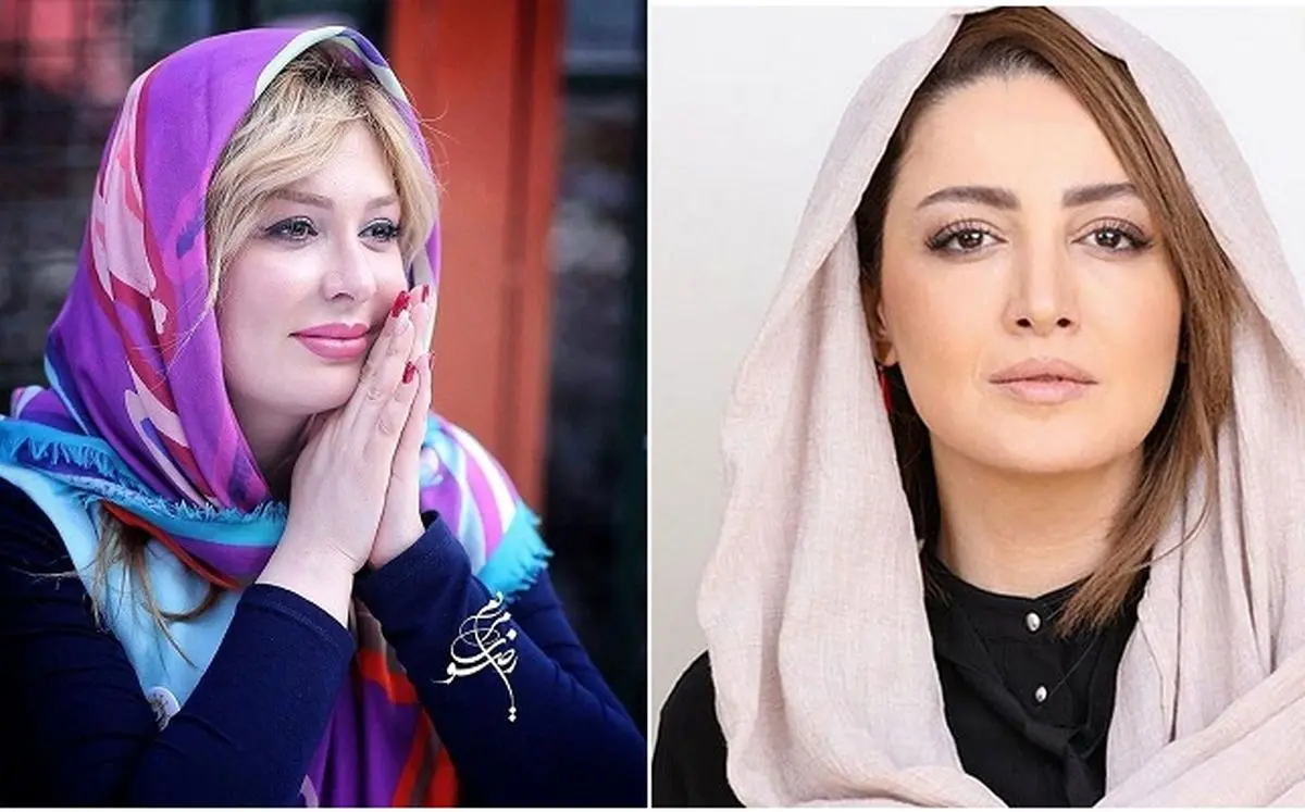 عمل بینی | بینی افراد مشهور قبل و بعد از عمل بینی عمل بینی | بینی افراد مشهور قبل و بعد از عمل بینی