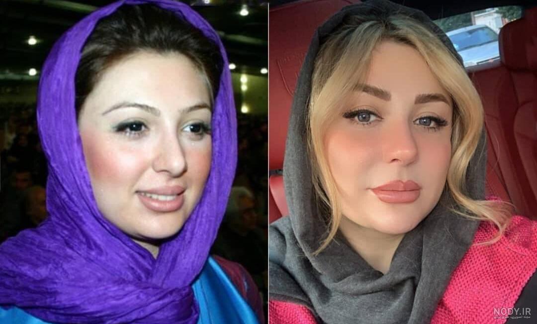 عمل جراحی سنگین نیوشا ضیغمی روی صورتش + عکس عمل جراحی سنگین نیوشا ضیغمی روی صورتش + عکس