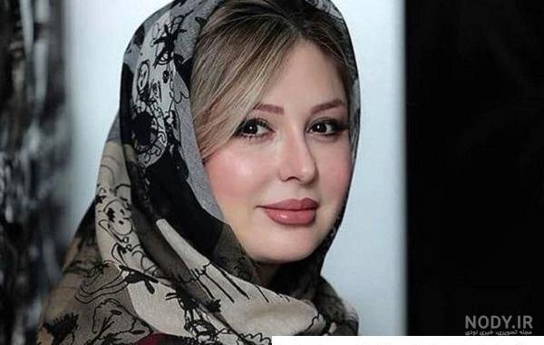 عکاسان جوان‎ | ‎تصاویر نیوشا ضیغمی بعد از عمل مجدد بینی . توضیح: ورق بزنید  لطفا‎ | Instagram